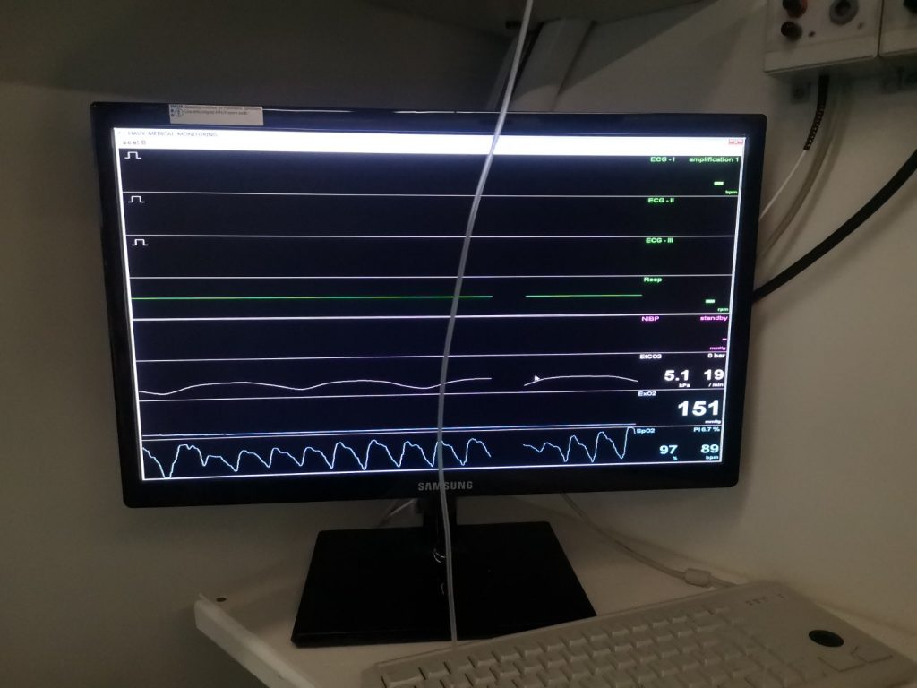 CO2 test - monitor - Dr Fanolic